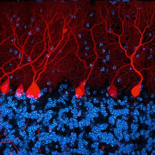 Клетки Пуркинье из мышиного мозжечка